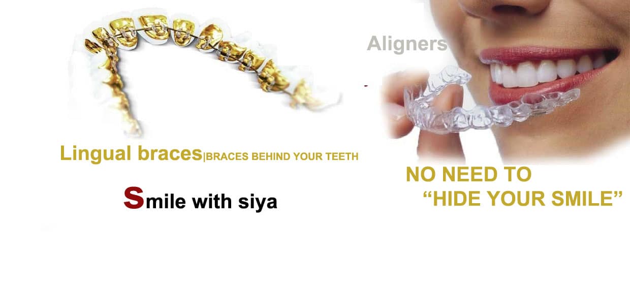 1 1 1240x567 1 1 1240x567