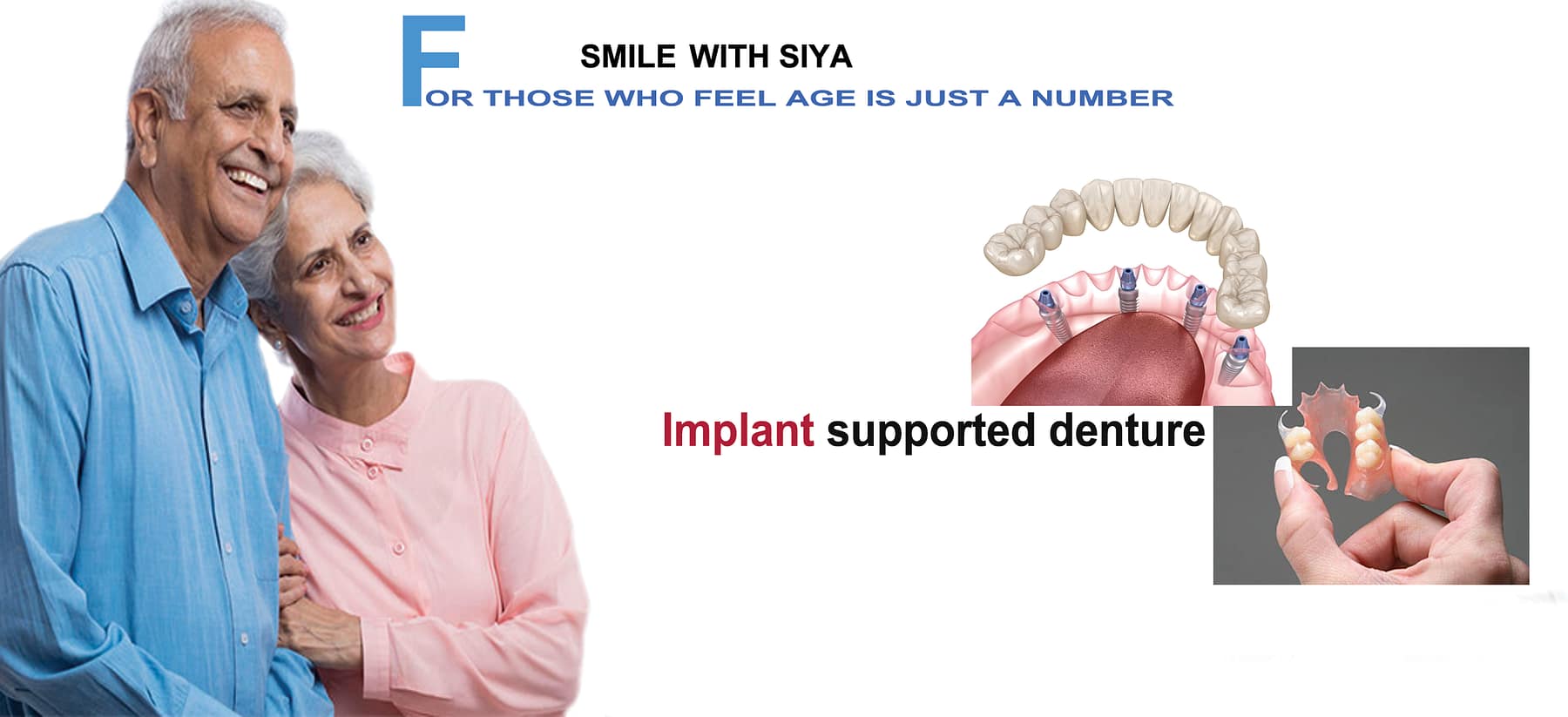 implant implant