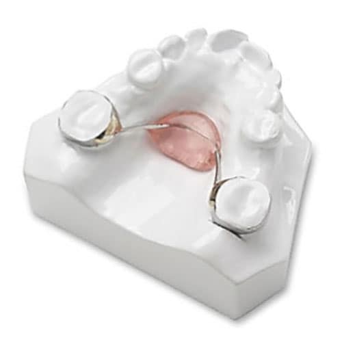 nance space maintainer