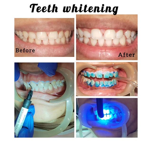 526484896 4700295156776427 6462970430744428716 n.