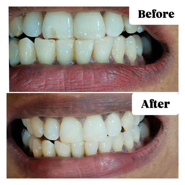 557410212 18105296866591177 3694047300947667256 n.