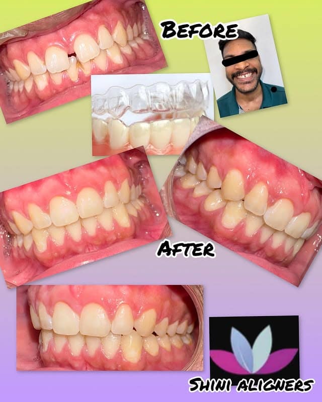 525538461 18098914474591177 2174854453514375447 n.