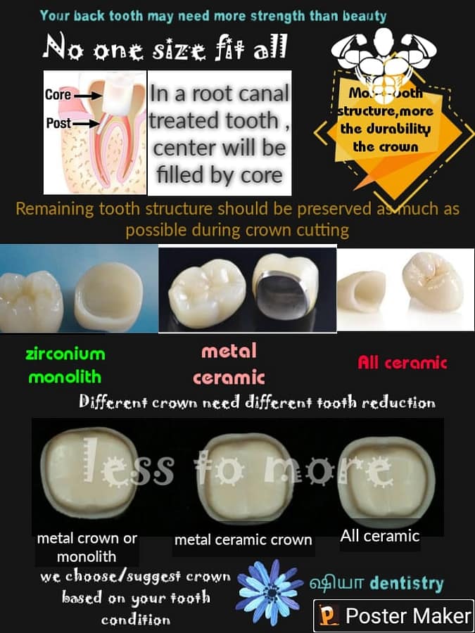 dental crown choosing