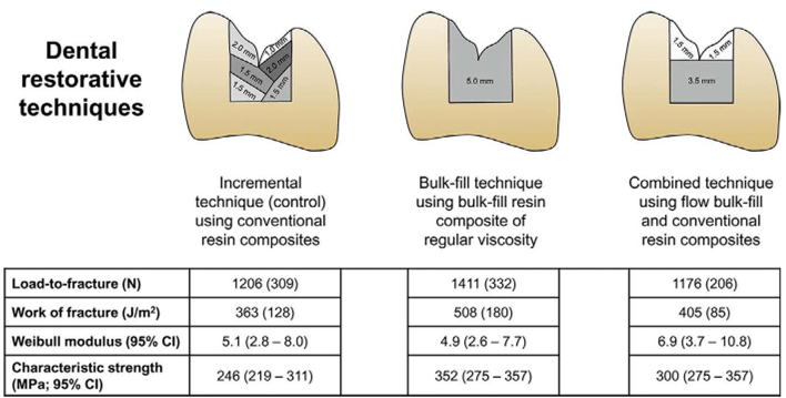 Class II caries,Dental filling longevity,cost of tooth filling in nagercoil