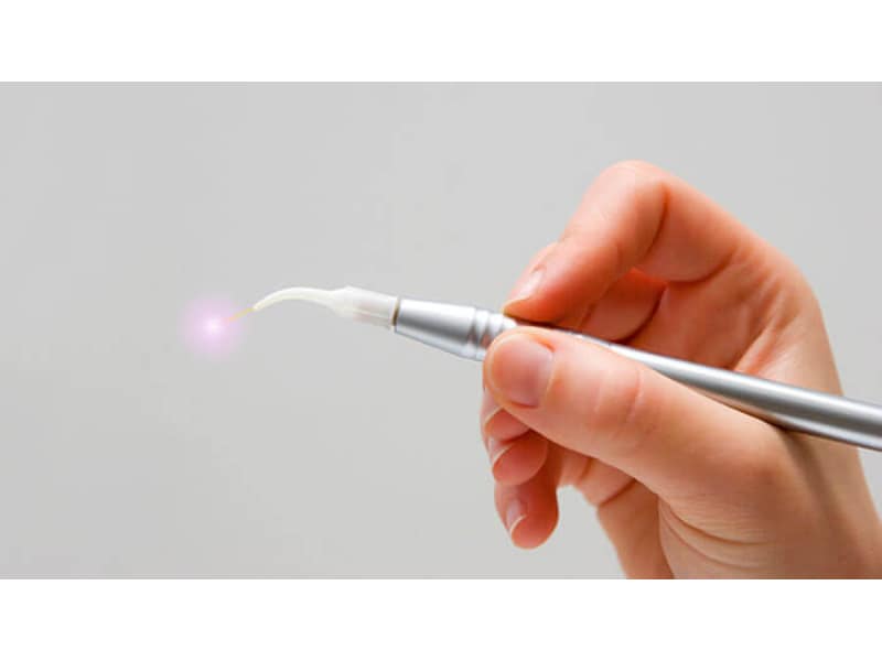 dental laser dental laser