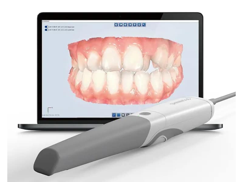 digital impression digital impression